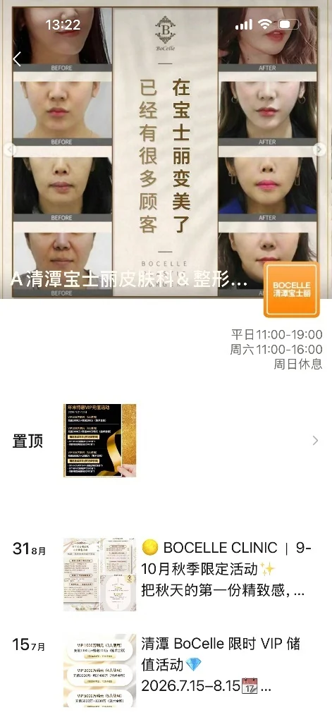 2. 위챗모멘트 (微信朋友圈)